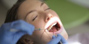 wisdom tooth extraction in Etobicoke